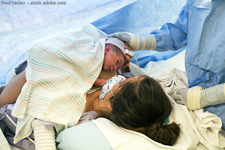 Frau kurz nach dem Kaiserschnitt hält ihr Kind in den Armen